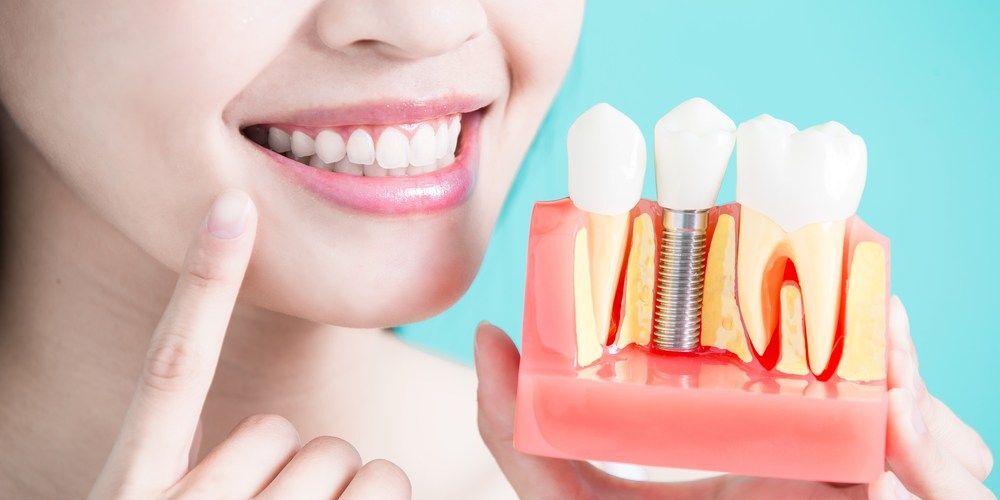 Bir Diş Kayıp Gider Ama İz Bırakır: Psikolojik Etkiler ve İmplantın Tedavi Edici Rolü